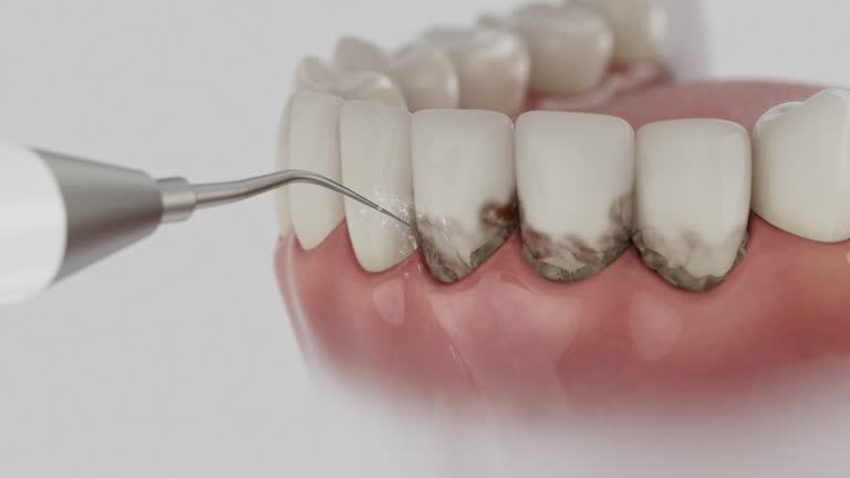 Trusted Root Canal Treatment service in Gresham Park, GA - Dentist Open Now